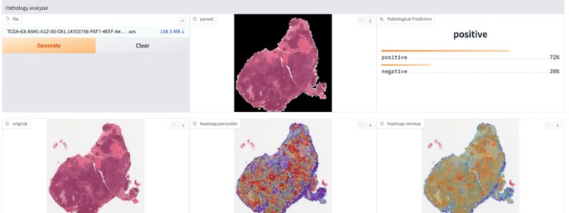 Histopatologiska bilder kan analyseras och visualiseras med Exaone Path för att identifiera möjliga genetiska förändringar i celler. Färgvariationer kan ge viktiga ledtrådar om potentiella genetiska förändringar eller abnormiteter i cellerna. Bild: LG AI Research