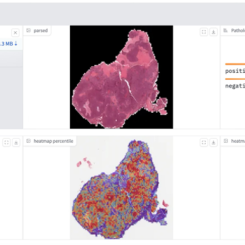 Histopatologiska bilder kan analyseras och visualiseras med Exaone Path för att identifiera möjliga genetiska förändringar i celler. Färgvariationer kan ge viktiga ledtrådar om potentiella genetiska förändringar eller abnormiteter i cellerna. Bild: LG AI Research